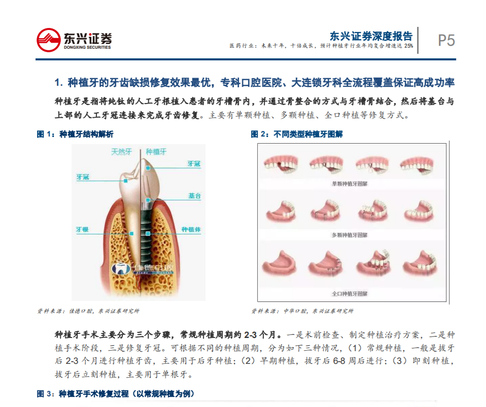 未來(lái)十年，十倍成長(zhǎng)，預(yù) 計(jì)種植牙行業(yè)年均復(fù)合增速達(dá)25%——東興證券